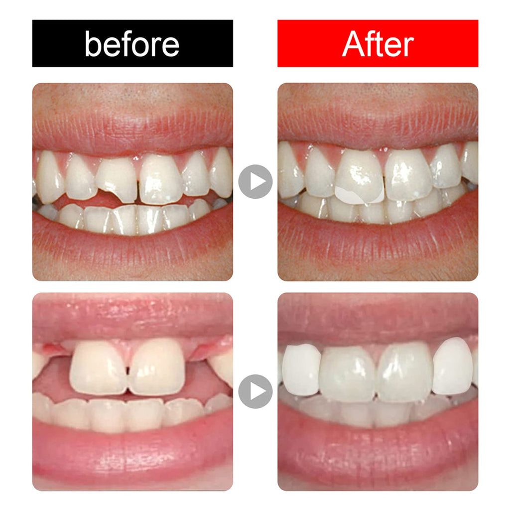 168 Pieces Acrylic Resin Denture Teeth 6 Sets 23 Shade A2 Upper + Lower B9298